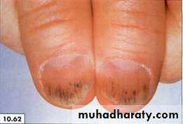 physical findings عملي