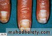 physical findings عملي