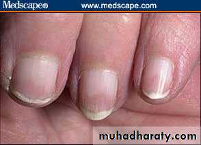 physical findings عملي