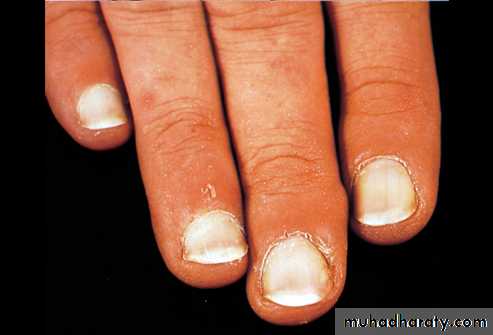 physical findings عملي
