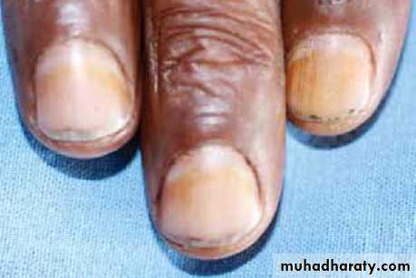 physical findings عملي