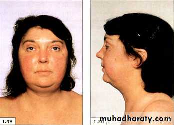 physical findings عملي