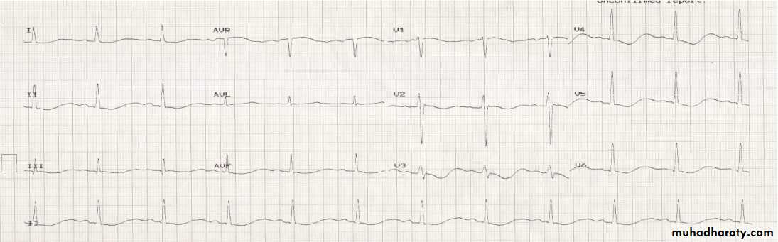 Cardio L2