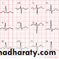 Cardio L2