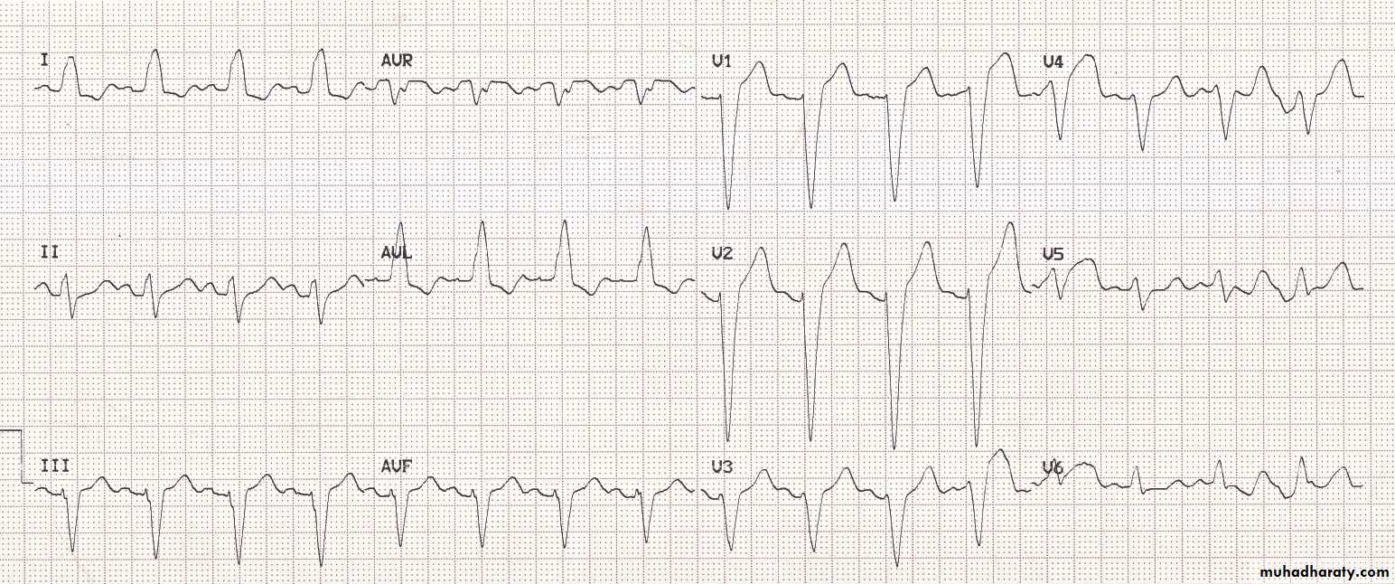 Cardio L2