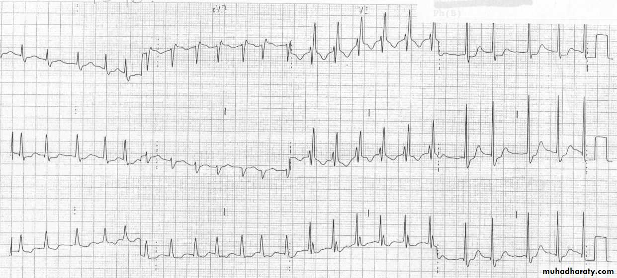 Cardio L2