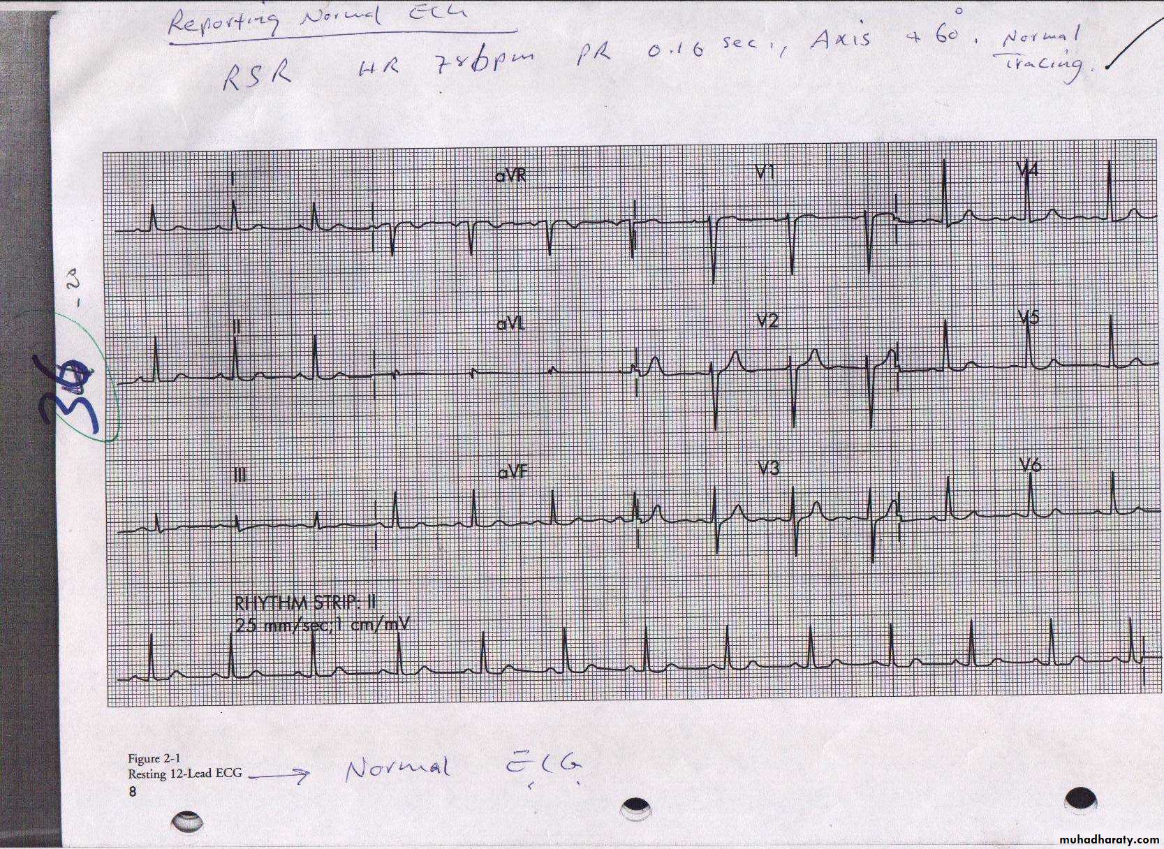 Cardio L2