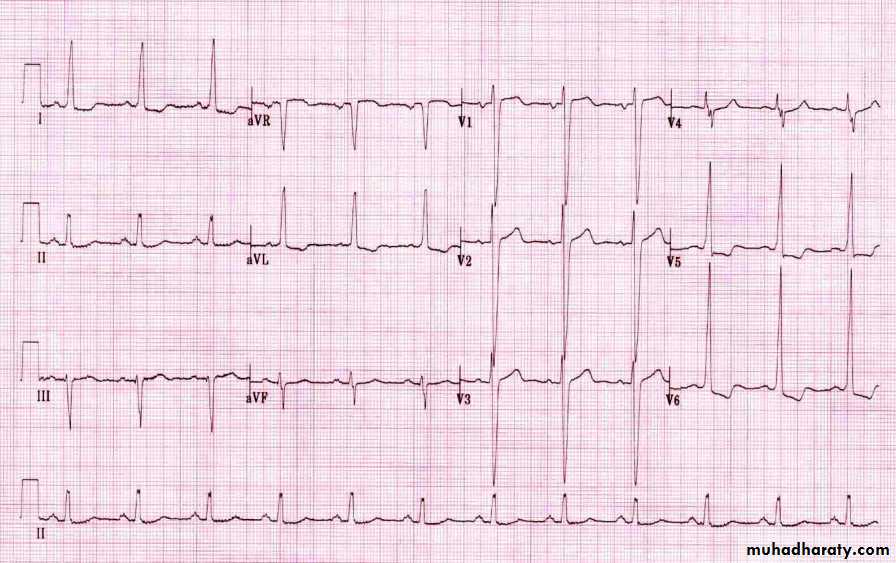 Cardio L2