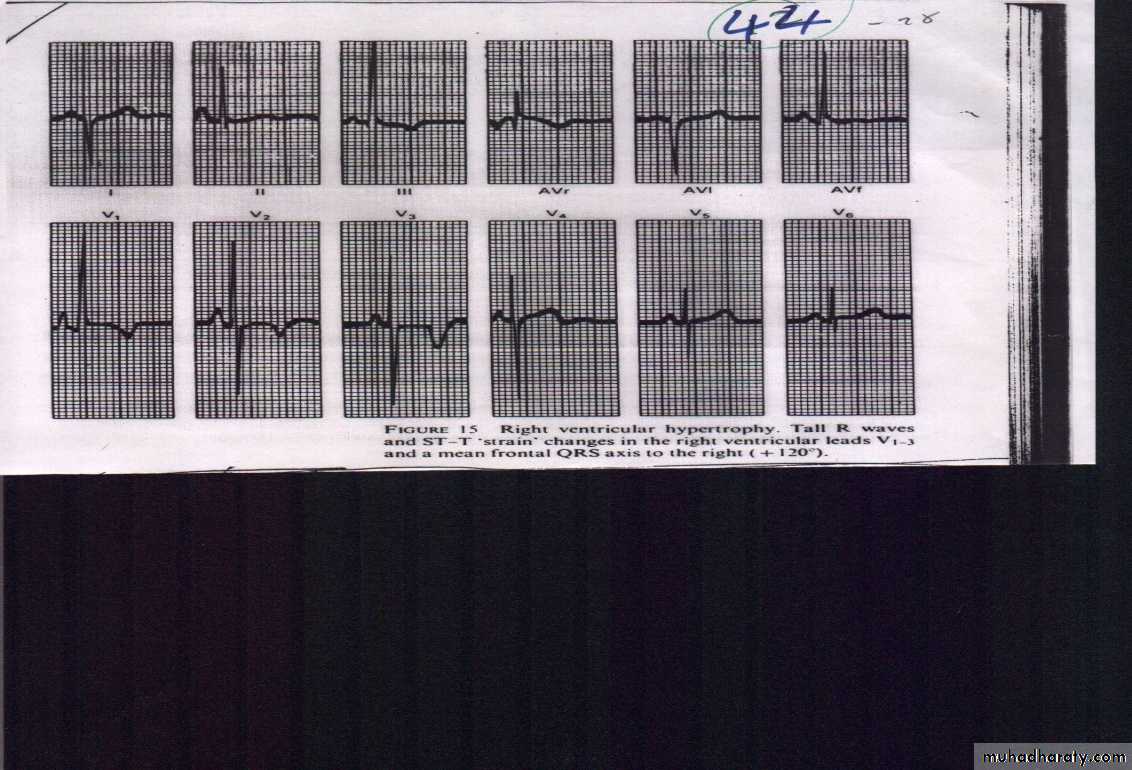 Cardio L2