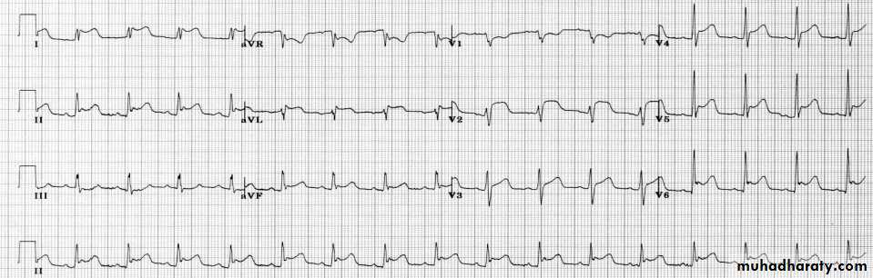 Cardio L2