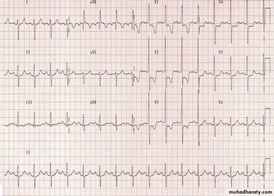 Cardio L2