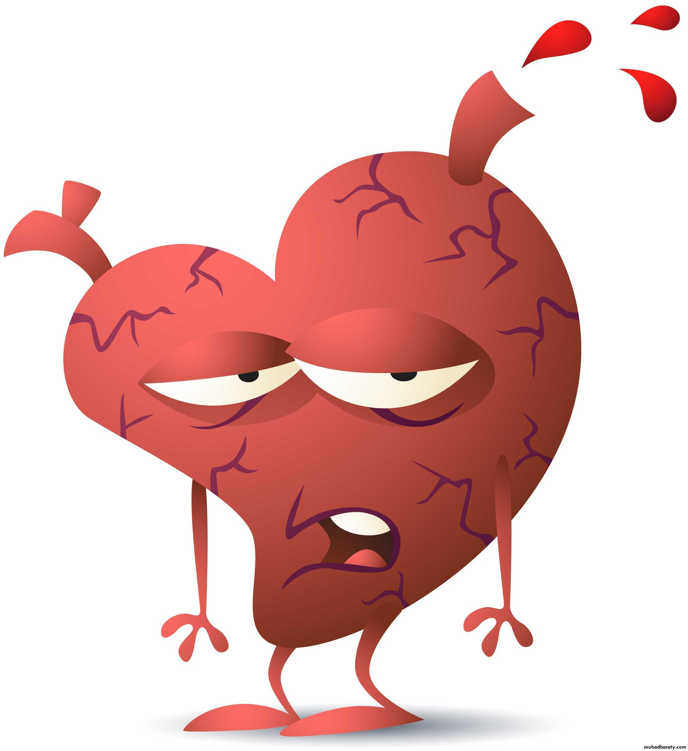 Valvular heart diseases