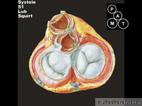 Valvular heart diseases