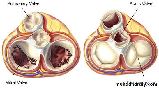 Valvular heart diseases