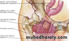 Spigelian hernia