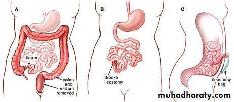 Small and large intestines