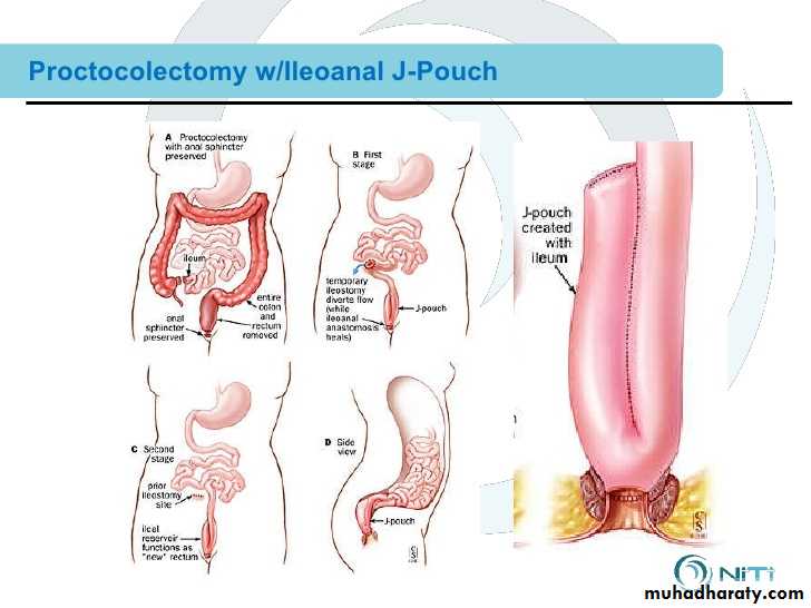 Small and large intestines
