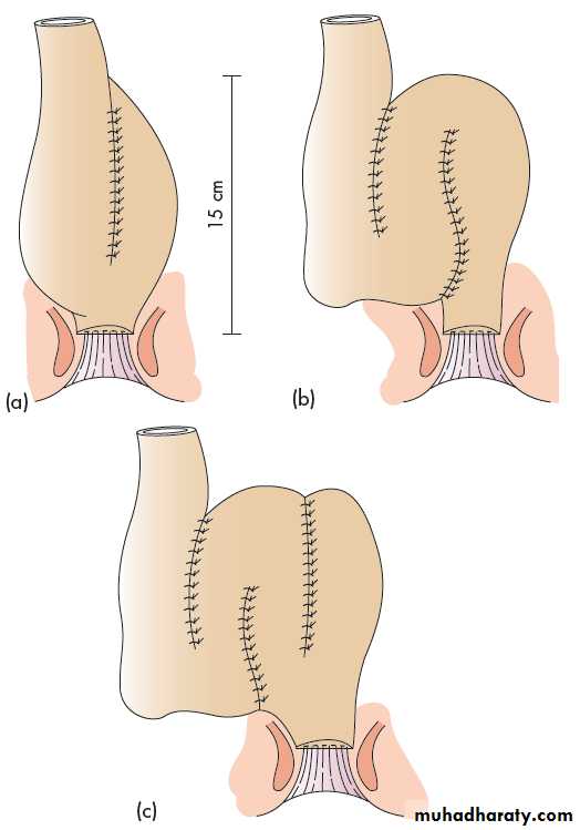 Small and large intestines