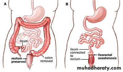 Small and large intestines