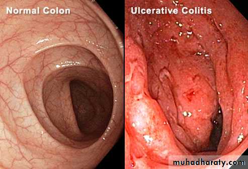 Small and large intestines