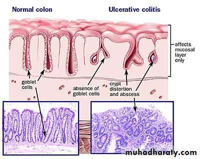 Small and large intestines