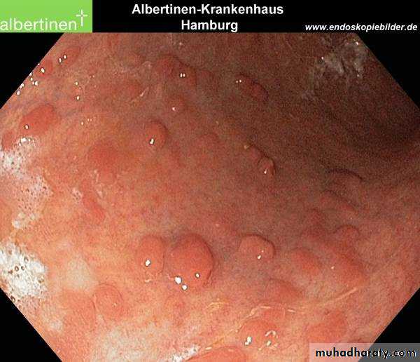 Small and large intestines