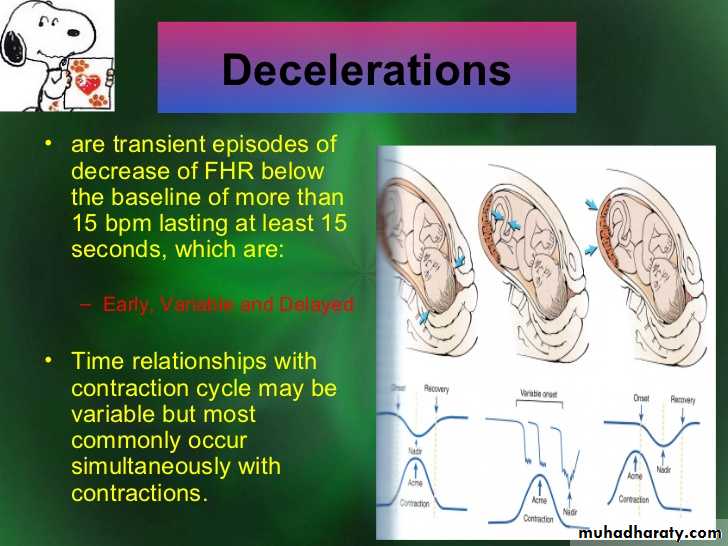 Intrapartum fetal monitoring