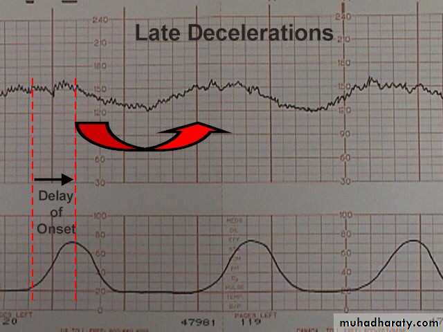 Intrapartum fetal monitoring