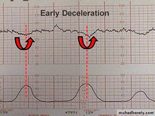 Intrapartum fetal monitoring