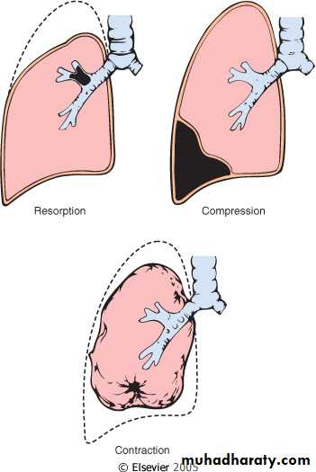 Respiratory system