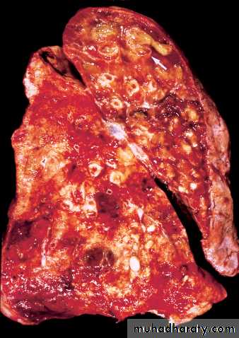 Respiratory system