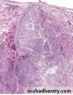 Respiratory system