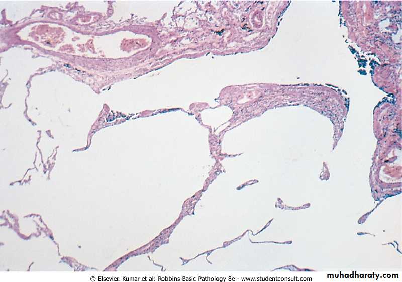Respiratory system