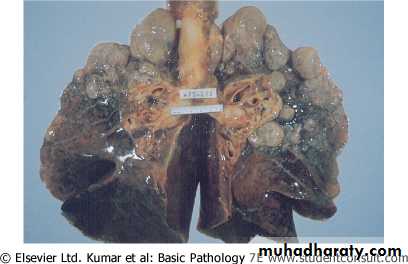 Respiratory system