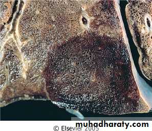 Respiratory system