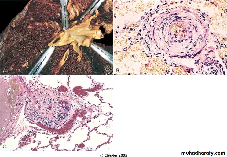 Respiratory system