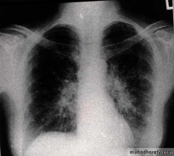 Respiratory system