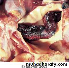 Respiratory system