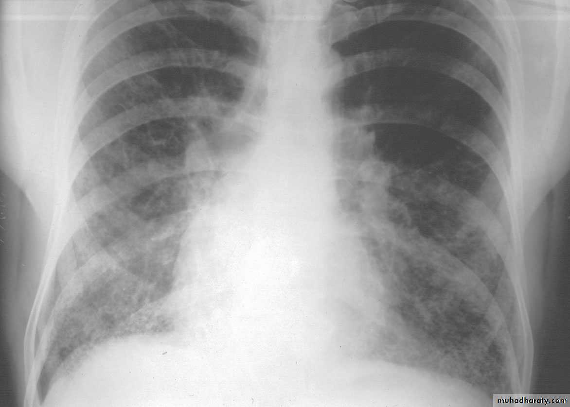 Respiratory system