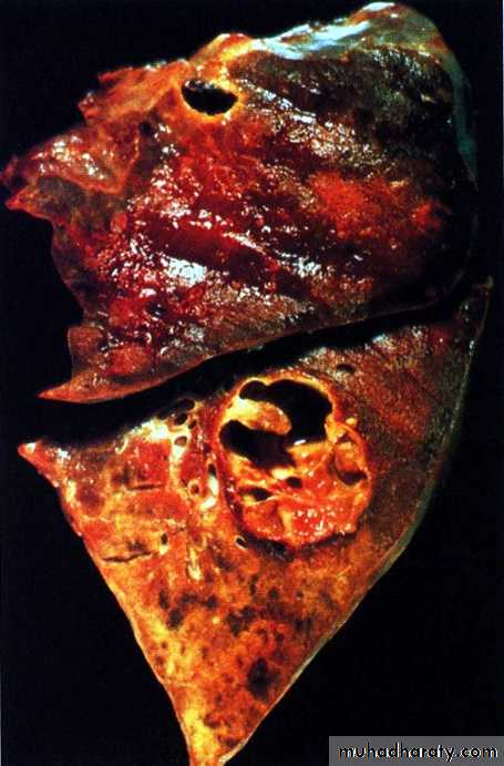 Respiratory system
