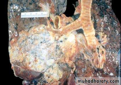 Respiratory system