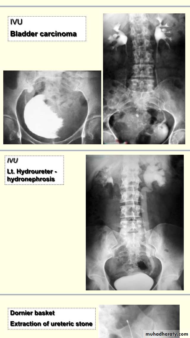urology slides