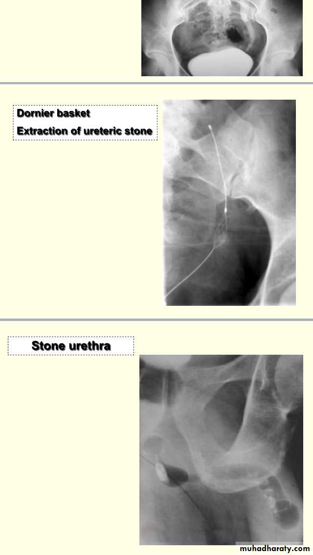 urology slides