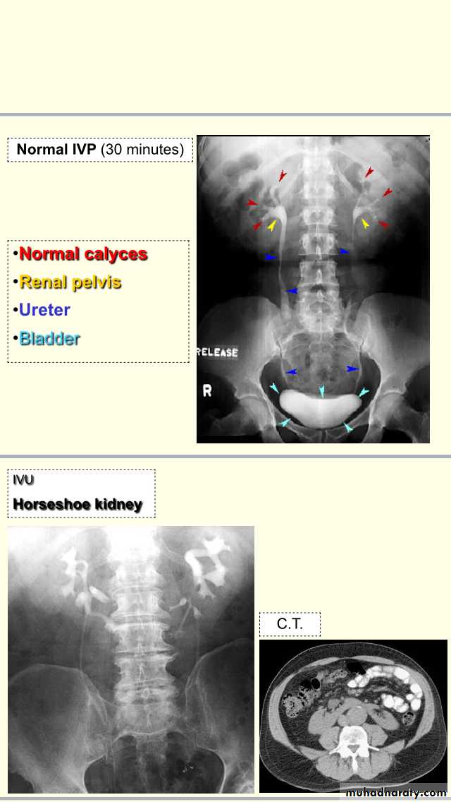 urology slides