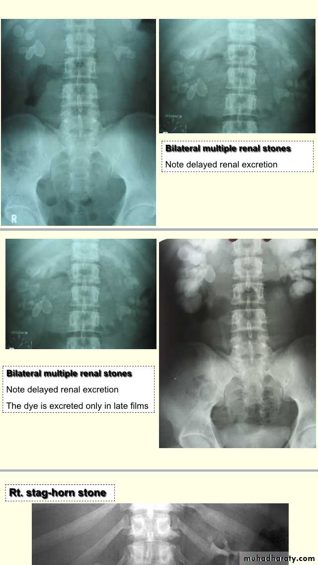 urology slides