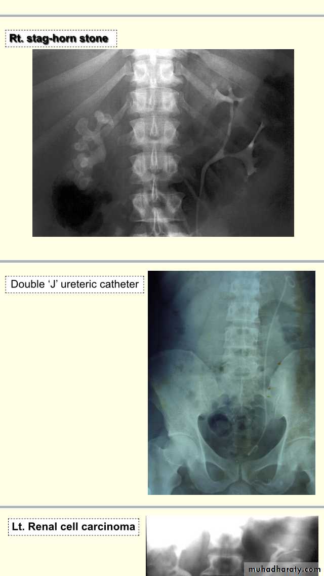 urology slides