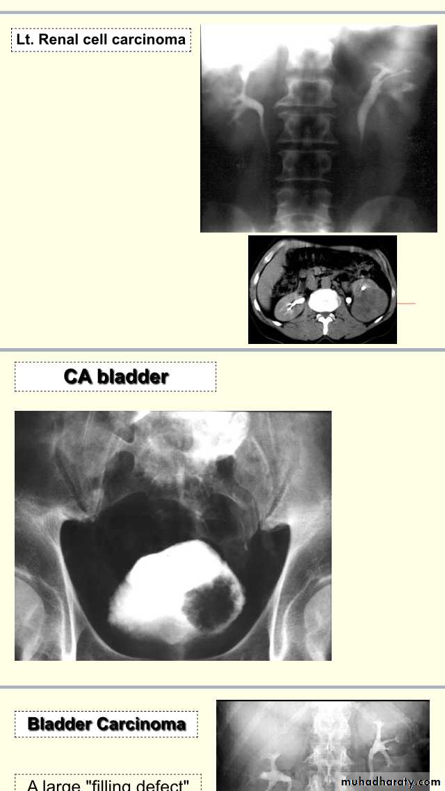 urology slides