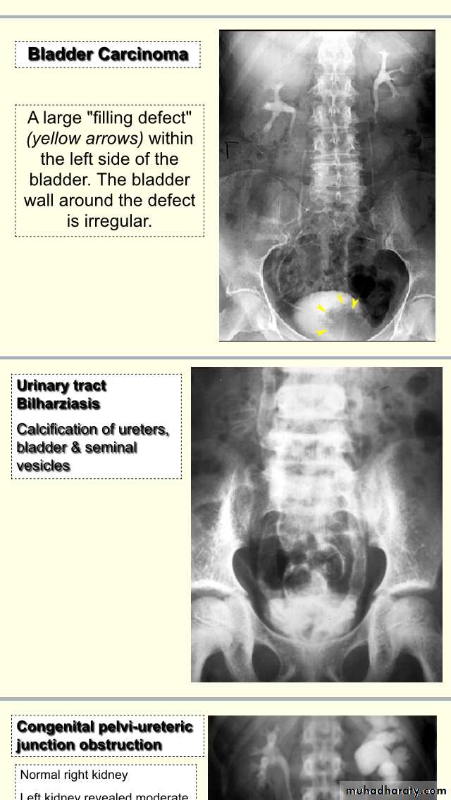 urology slides