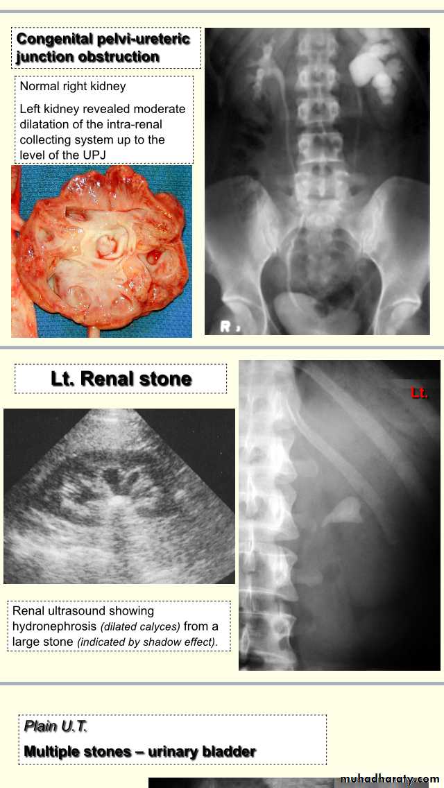 urology slides