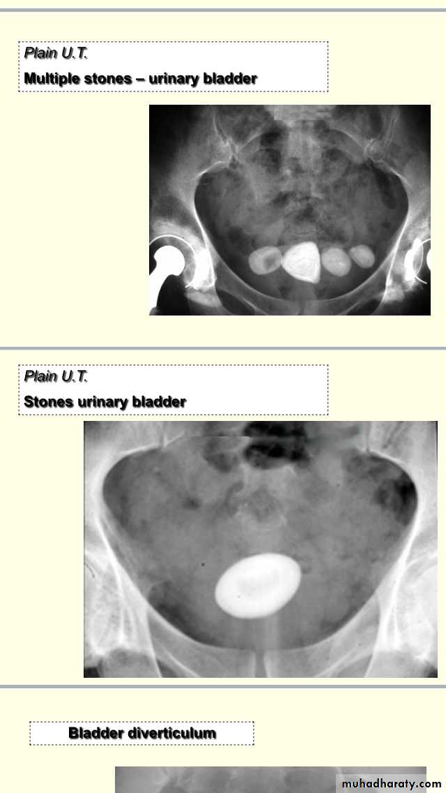 urology slides